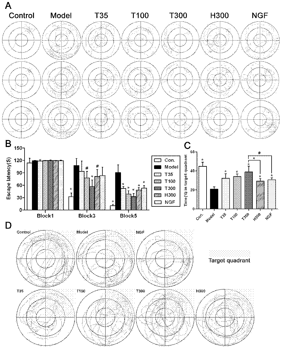 Novel brain targeting preparation for preventing and treating neurodegenerative disease