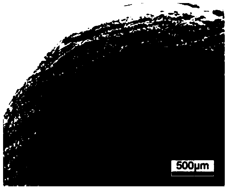 A kind of preparation method of three-layer structure small diameter vascular stent