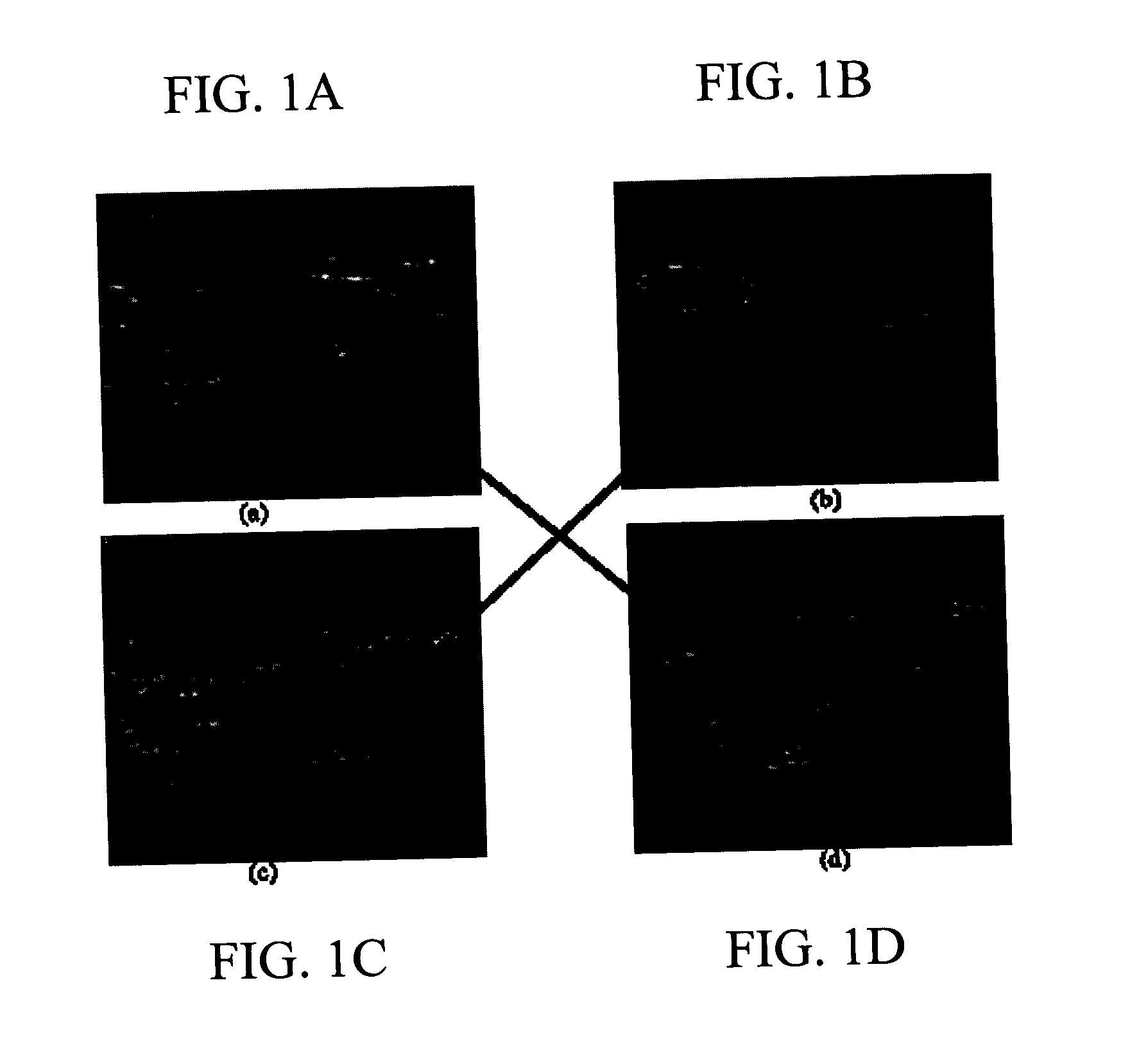 Method, system, and computer software product for feature-based correlation of lesions from multiple images