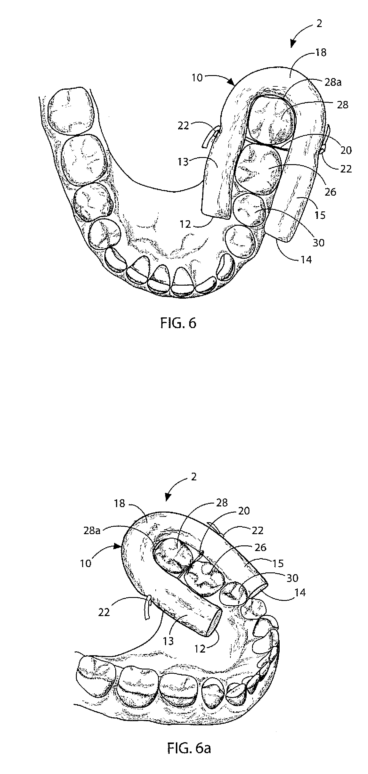 Dental isolator