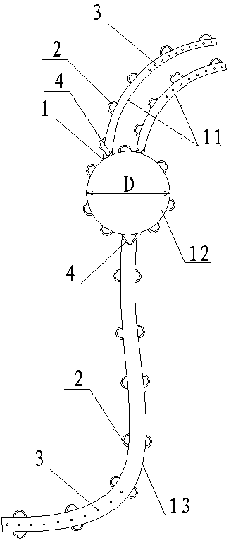 Special in-vivo drainage device for upper limb lymphedema of breast cancer postoperative complications and using method of special in-vivo drainage device