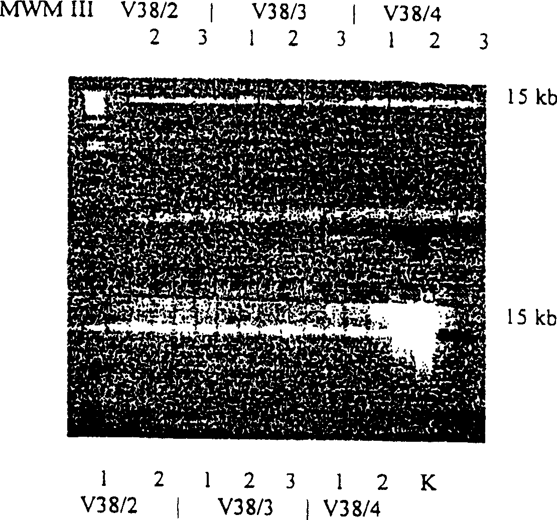 Enzyme reaction method for nucleic acid and composition for separating nucleic acid