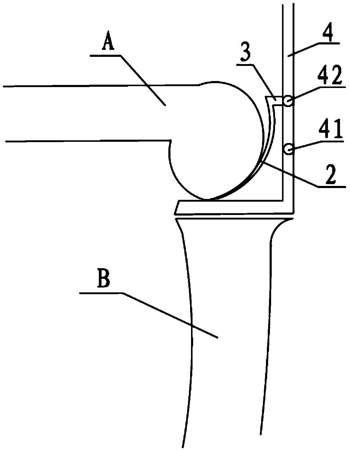 Femoral condyle measuring device used for unicompartmental knee arthroplasty