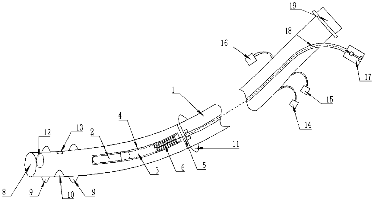 Trachea cannula