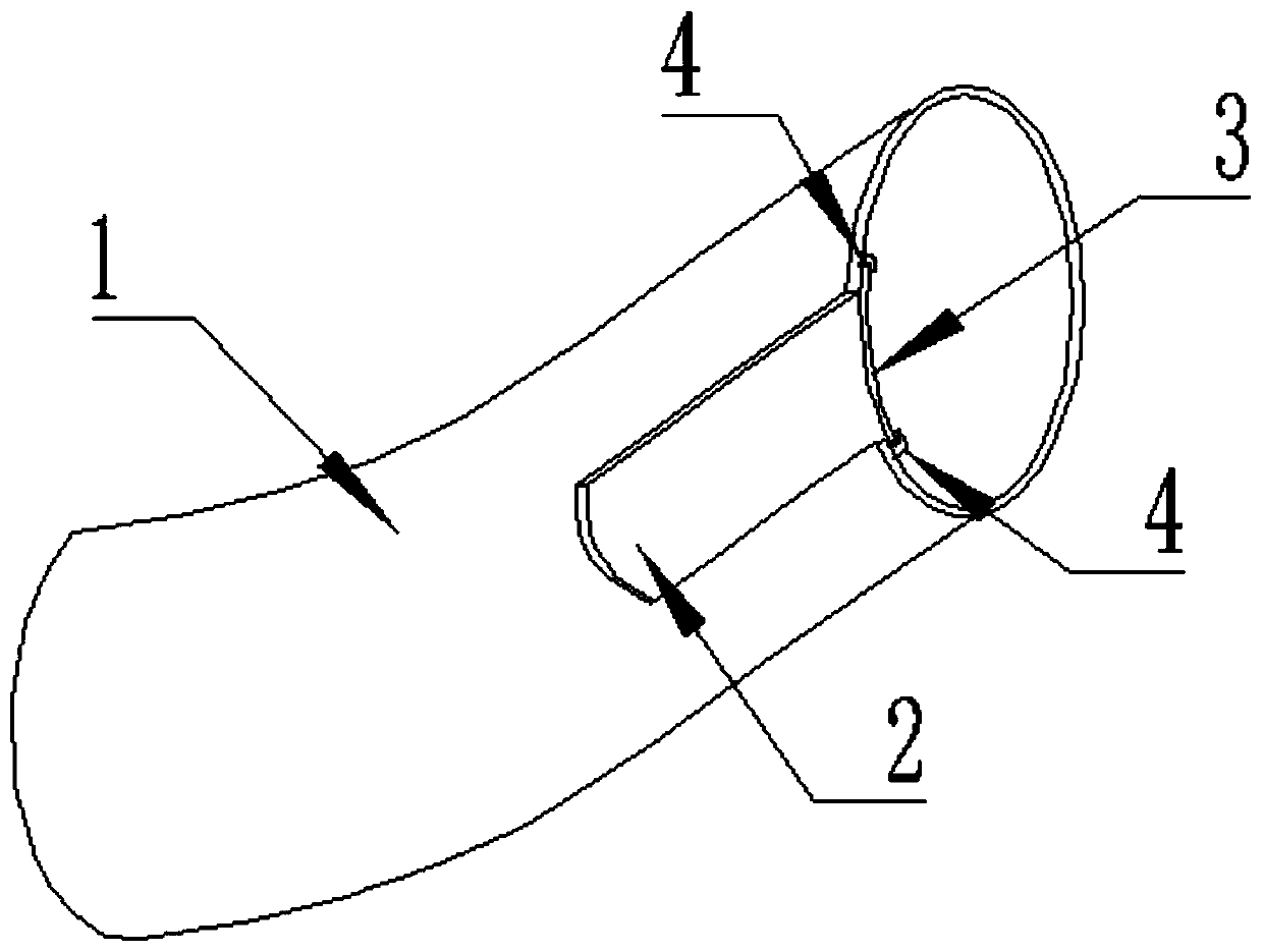 Trachea cannula