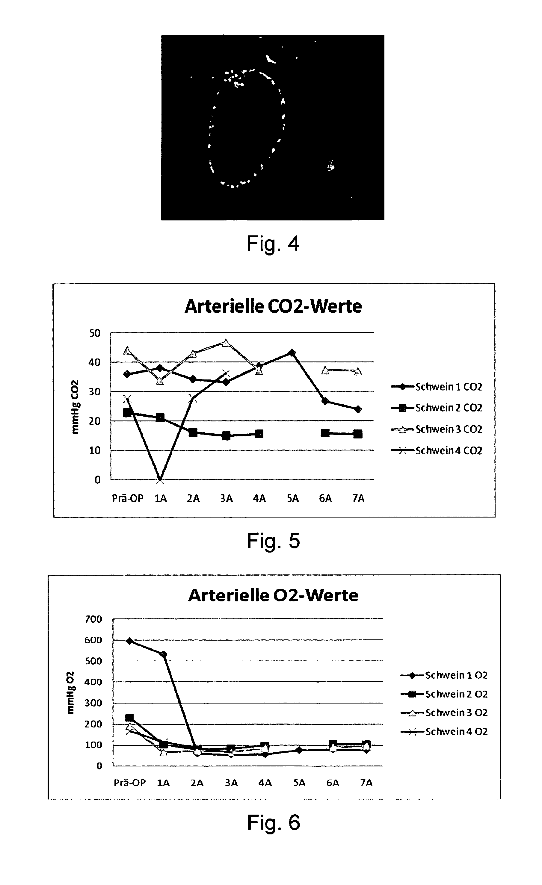 Device for the treatment of biological fluid