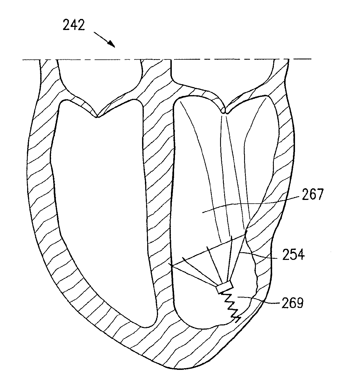 Systems and methods for improving cardiac function