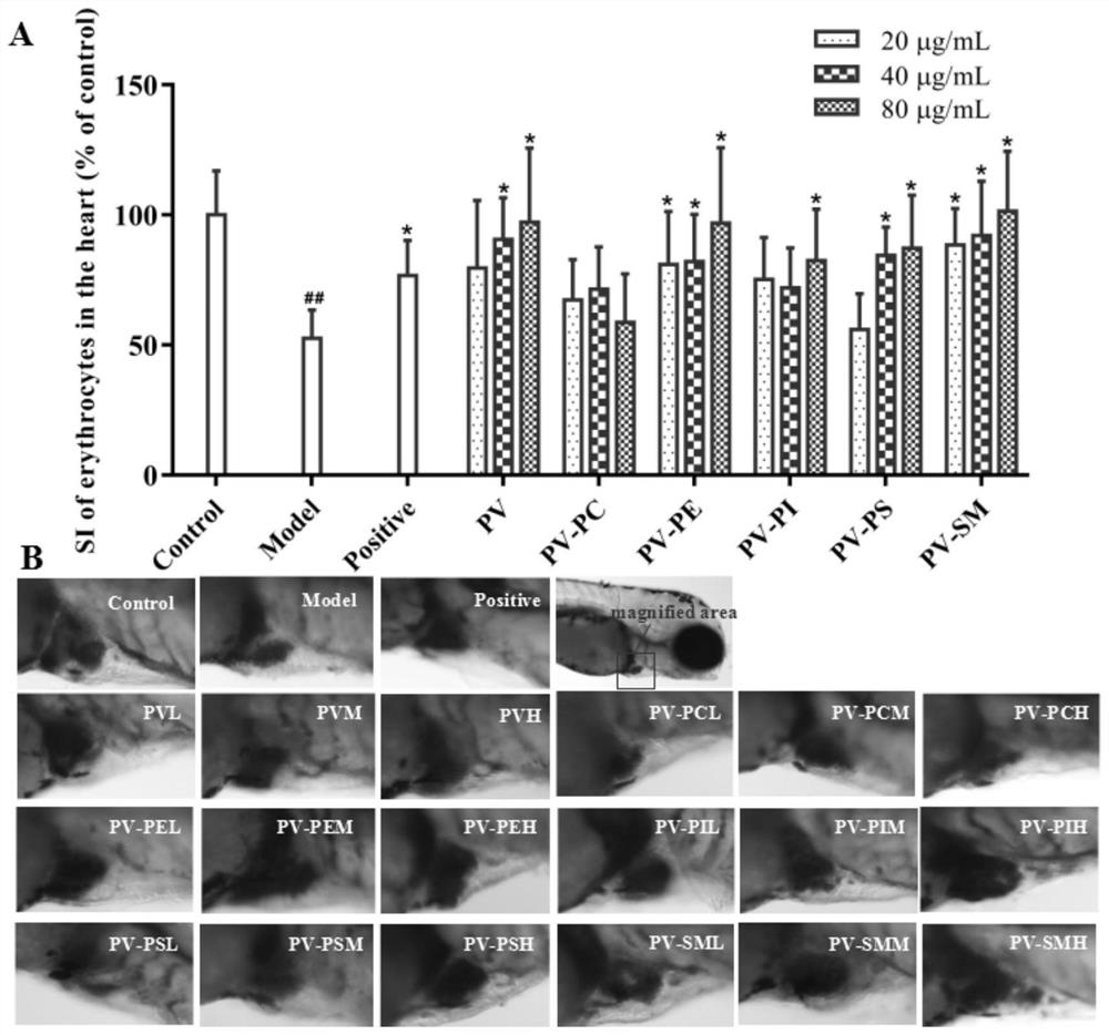 Application of marine phospholipid as effective component in preparation of medicine for preventing and/or treating heart diseases