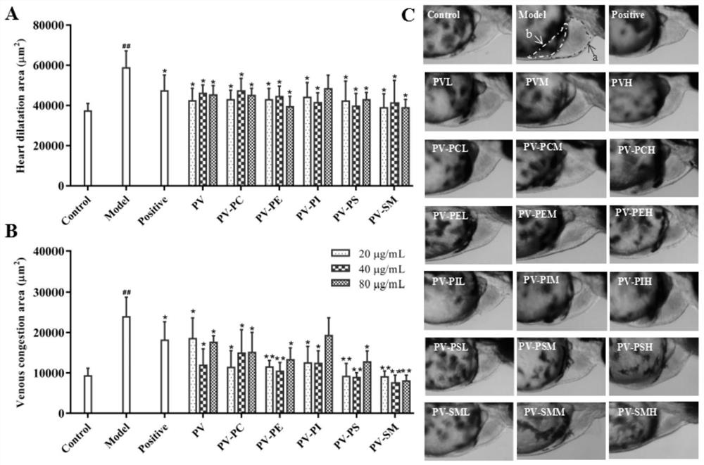 Application of marine phospholipid as effective component in preparation of medicine for preventing and/or treating heart diseases