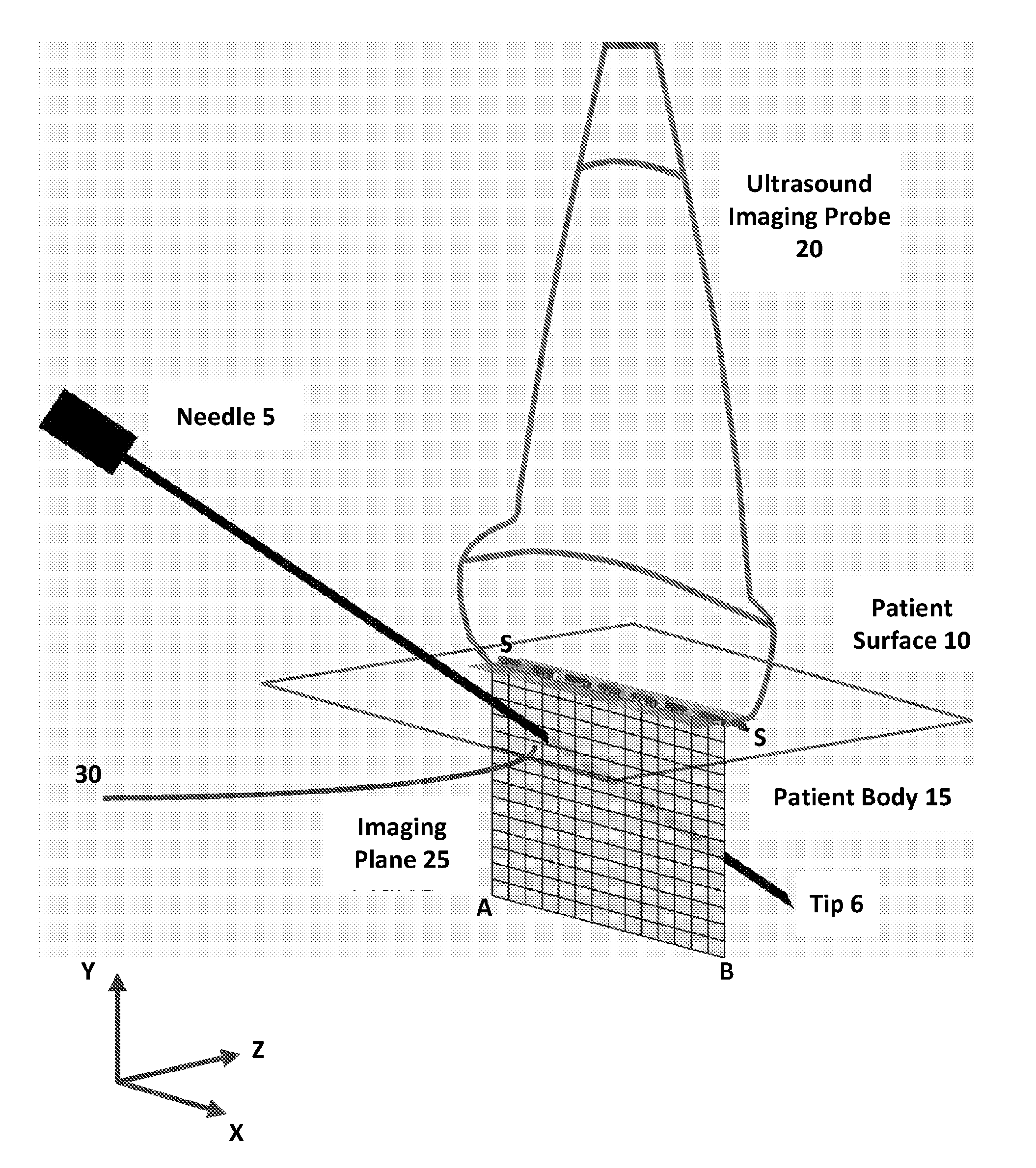 A method and apparatus for determining the location of a medical instrument with respect to ultrasound imaging, and a medical instrument to facilitate such determination