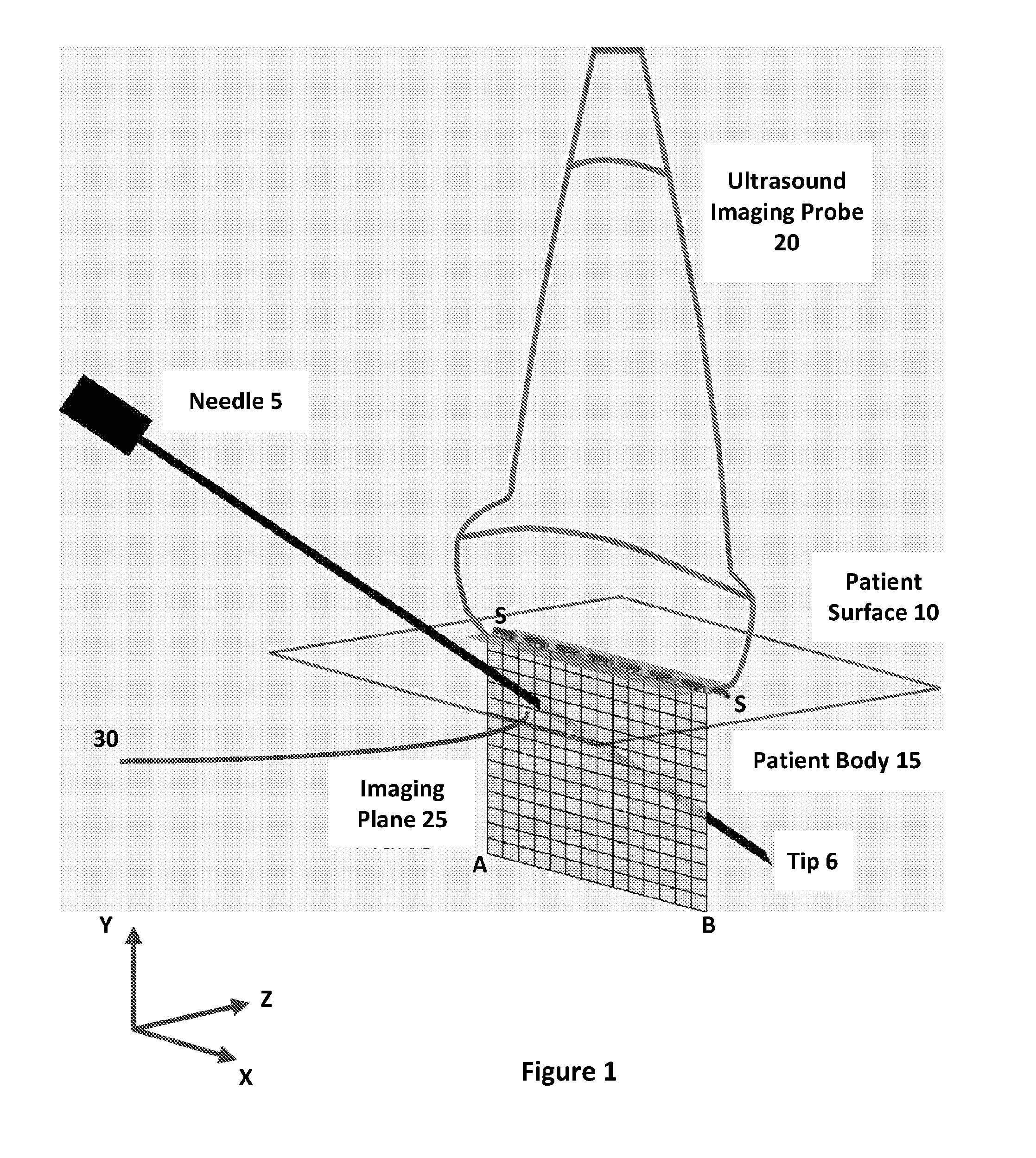 A method and apparatus for determining the location of a medical instrument with respect to ultrasound imaging, and a medical instrument to facilitate such determination