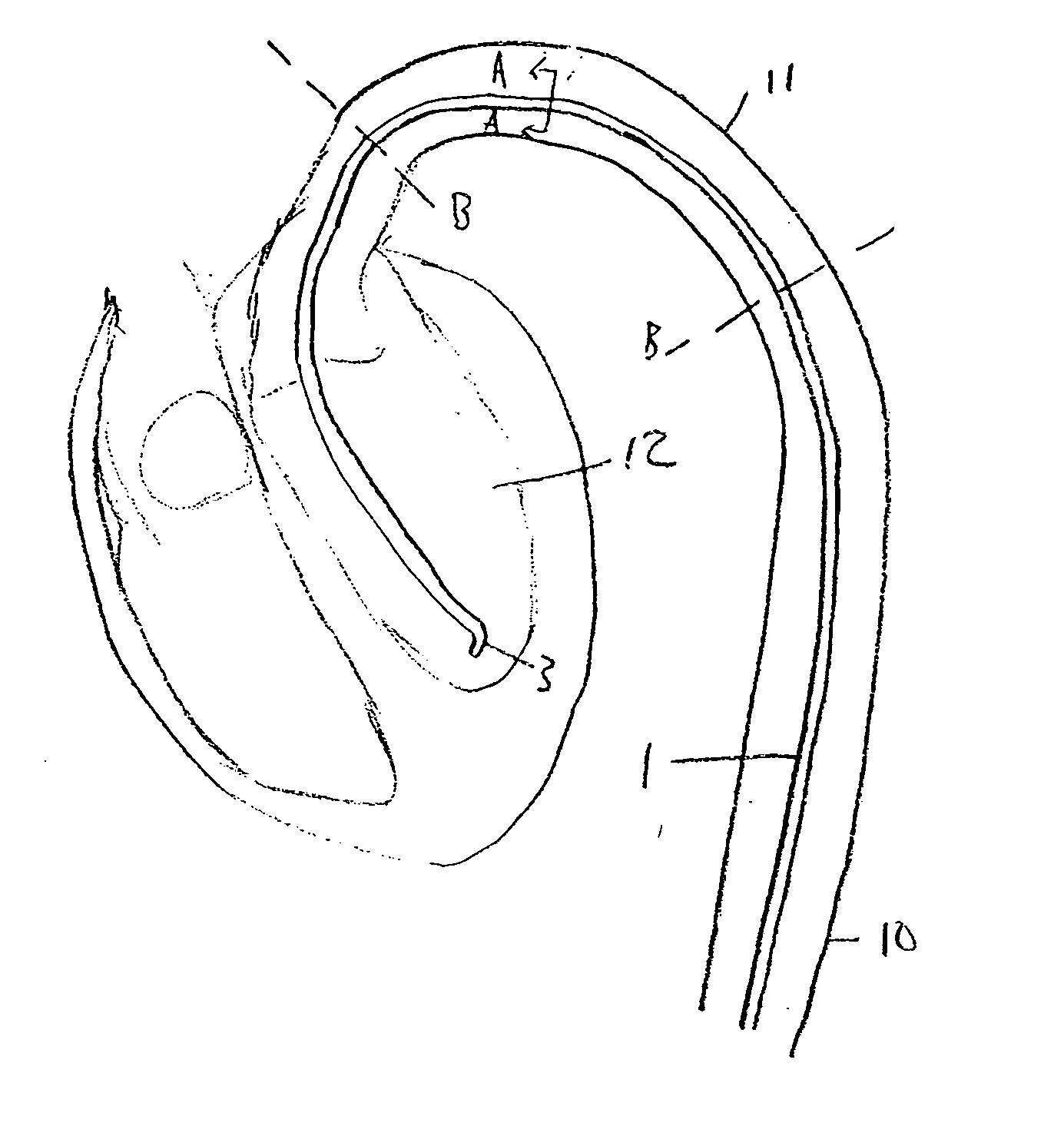 Medical device guidance from an anatomical reference