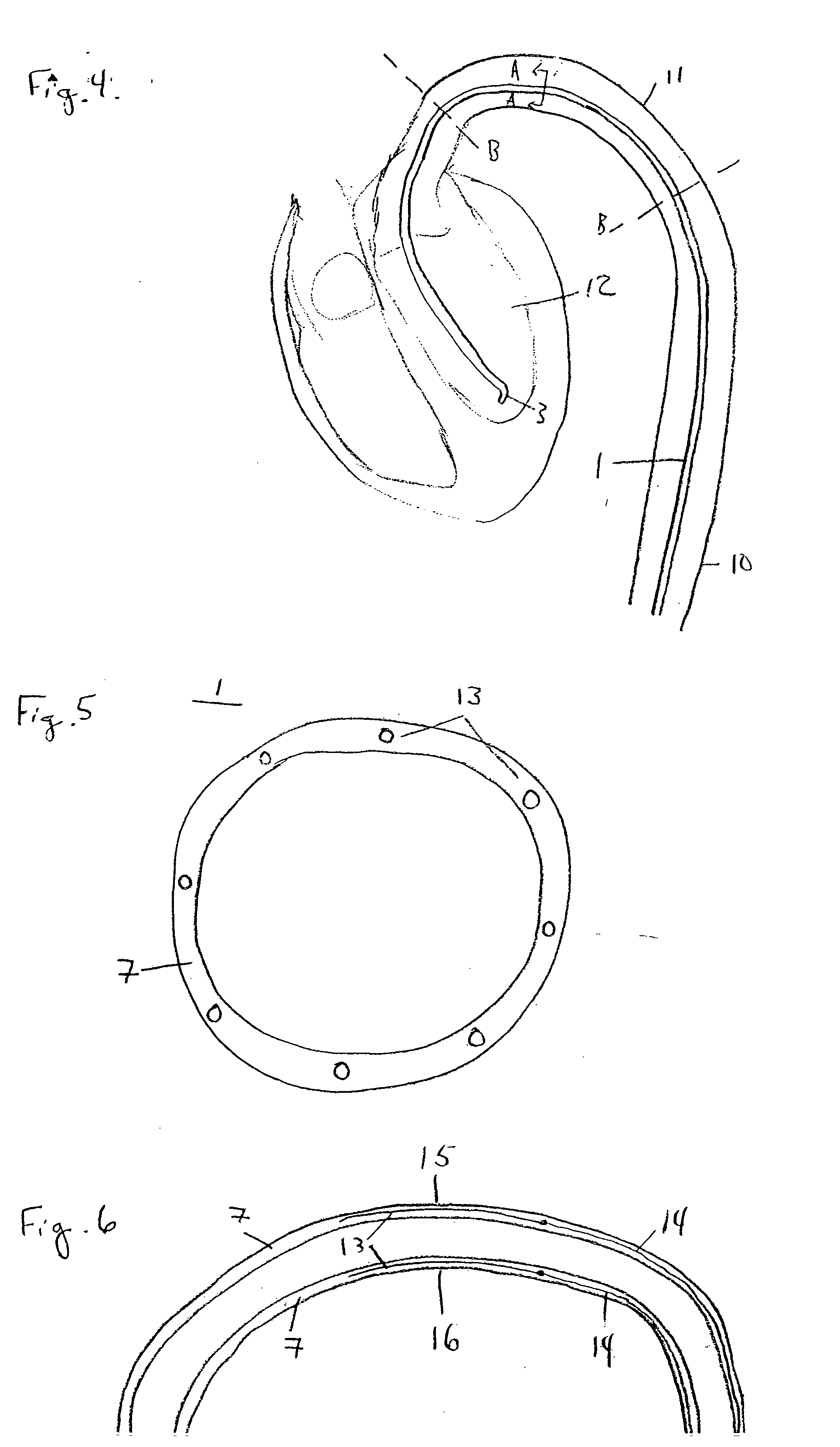 Medical device guidance from an anatomical reference