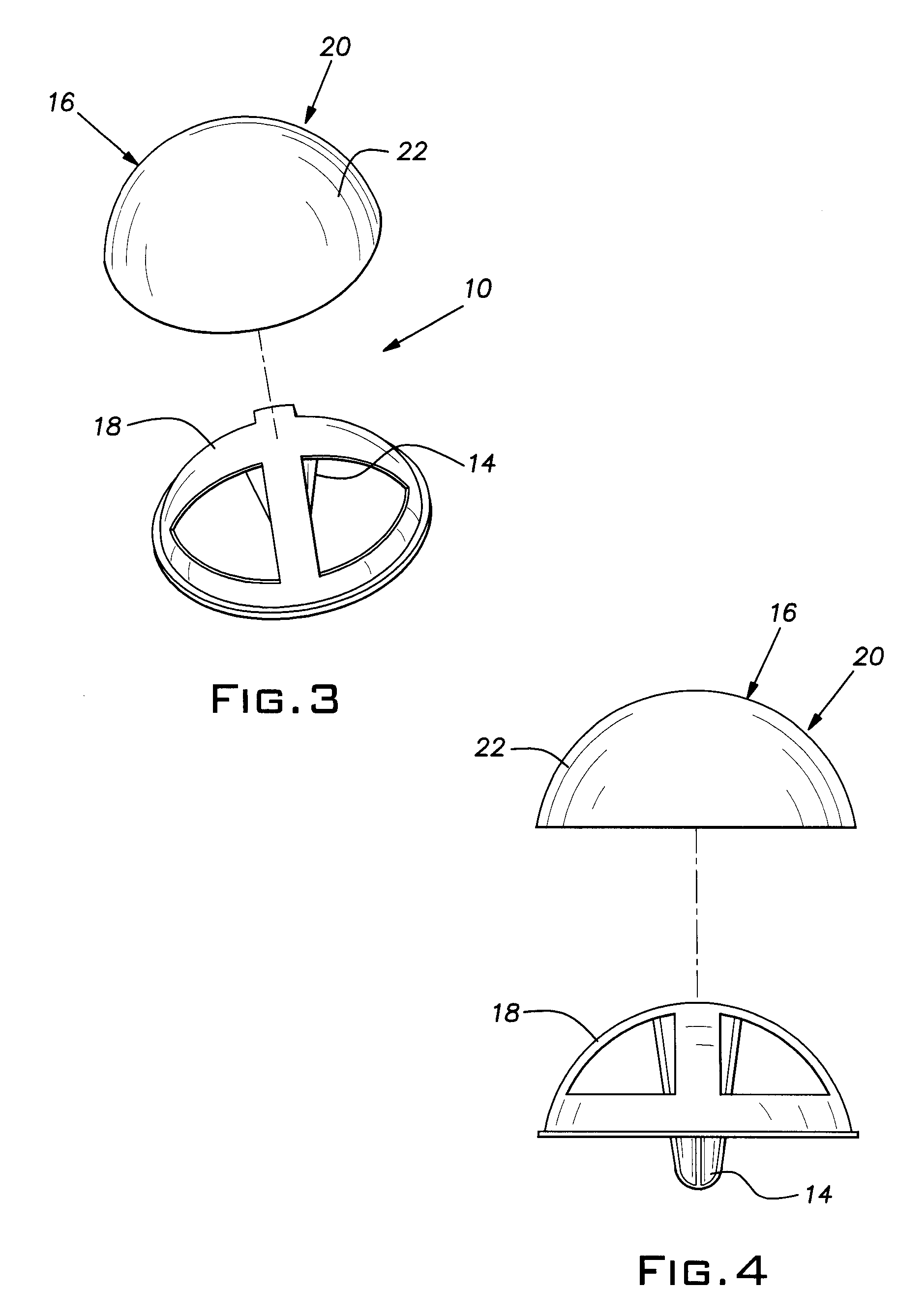 Orthopedic Implants Coated with Pyrolytic Carbon