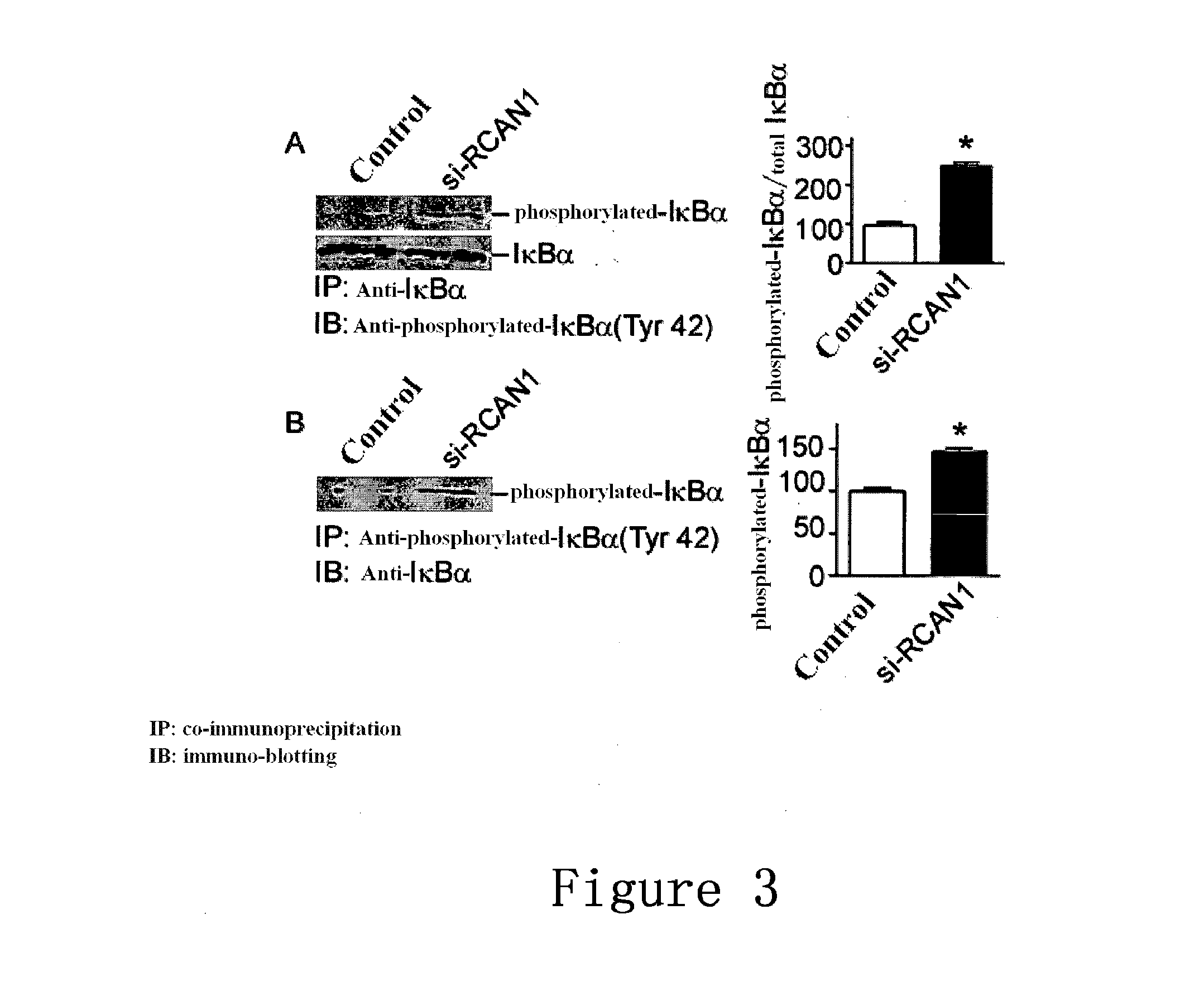 Use of regulator of calcineurin 1 for manufacturing medicament for treatment of diseases associated with increased nf-kb activity