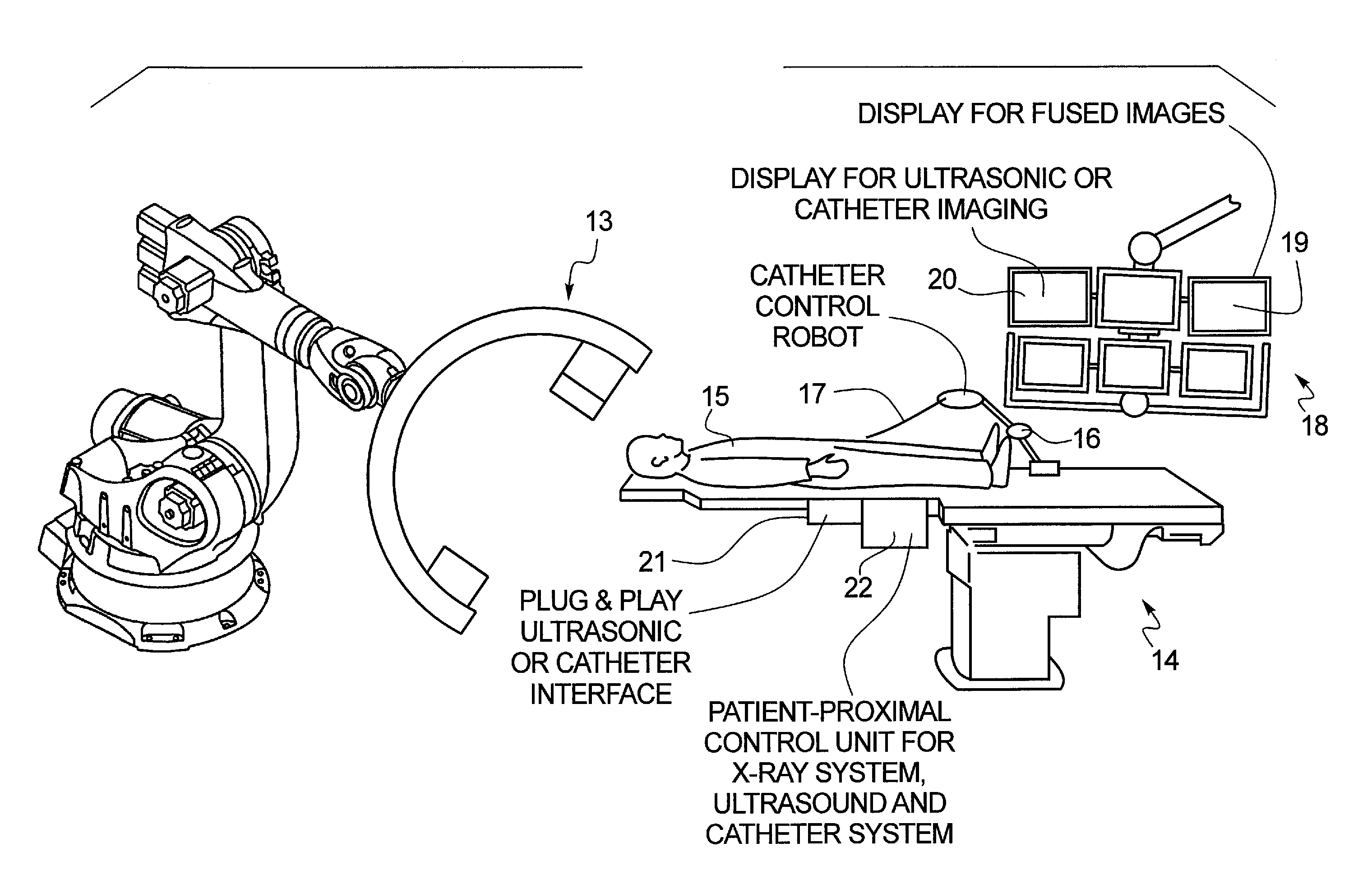 Method and apparatus for conducting an interventional procedure involving heart valves using a robot-based x-ray device