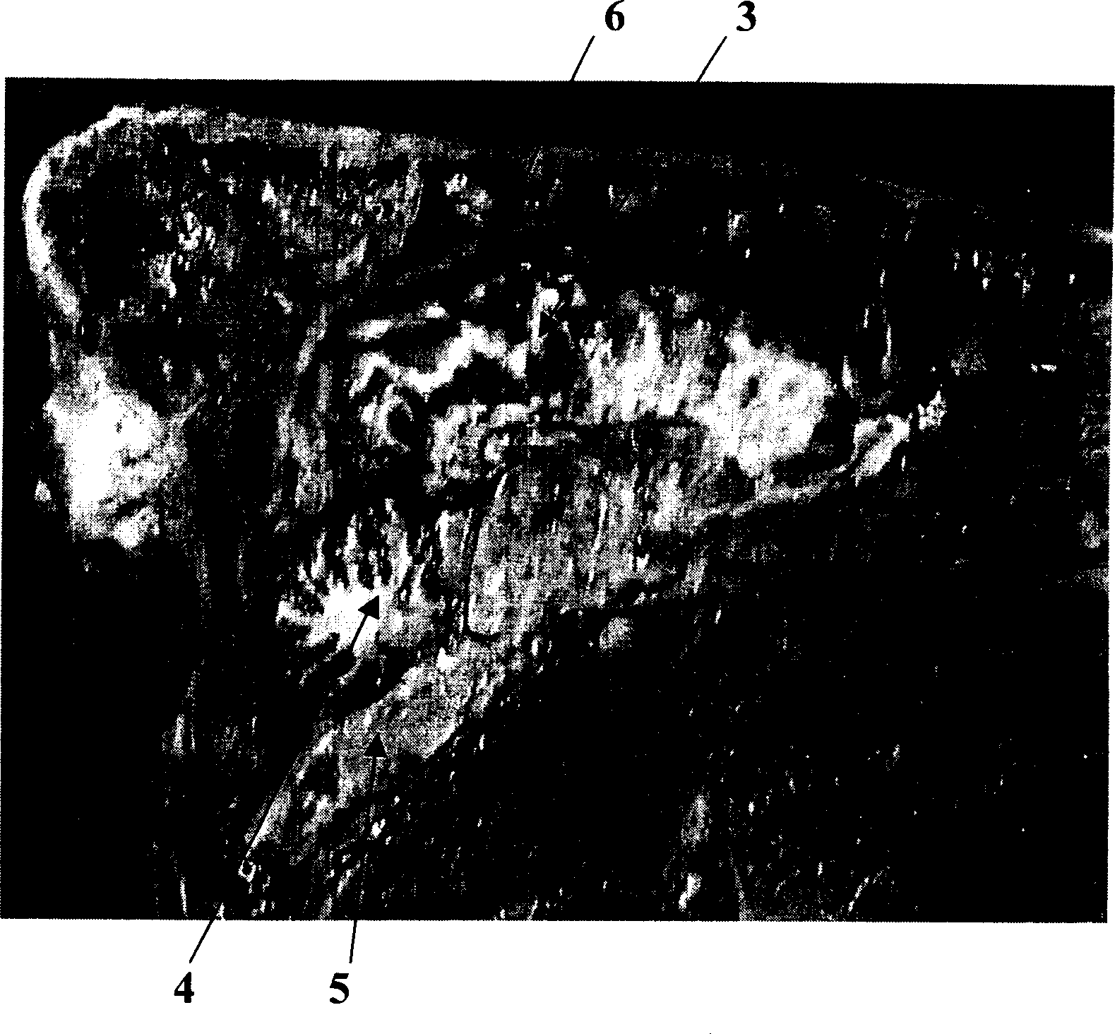 Cow brain tissue sampling method