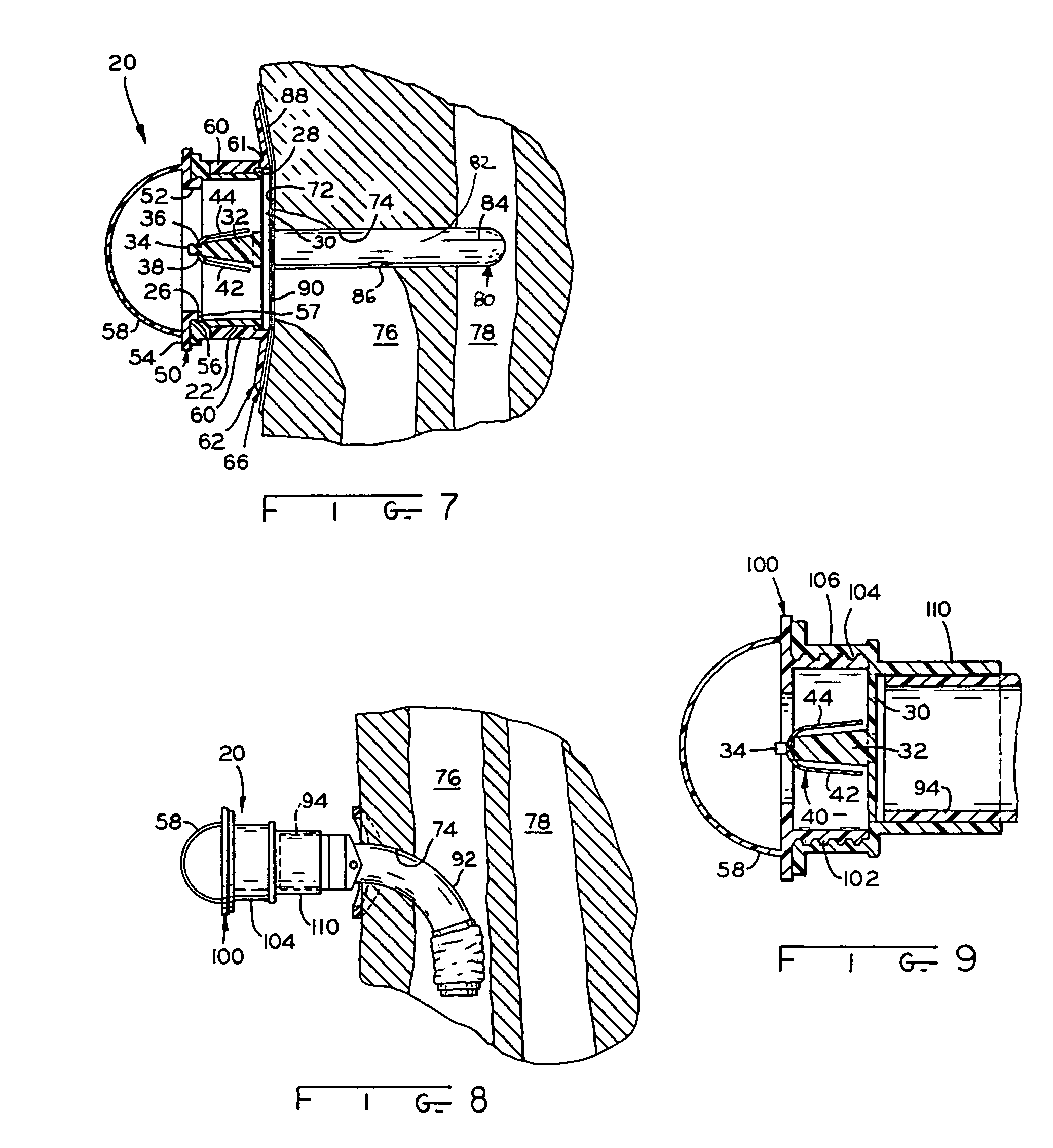 Method and apparatus for a tracheal valve