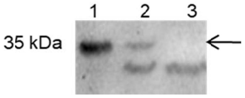 GLP-1R/GIPR dual-target agonist fusion protein as well as preparation method and application thereof