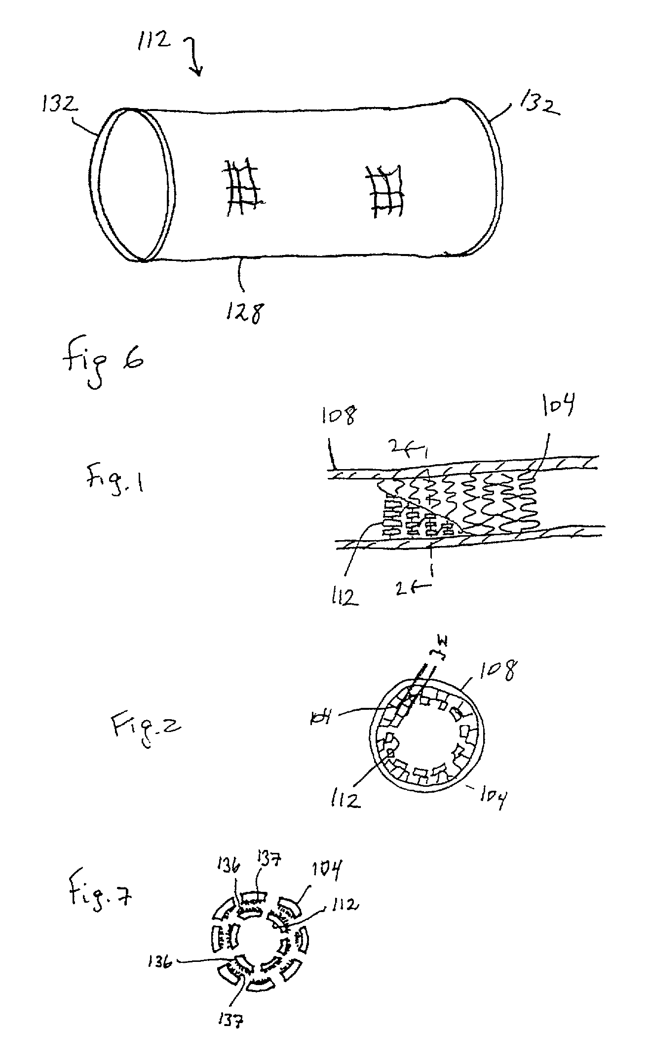 Stent for in-stent restenosis