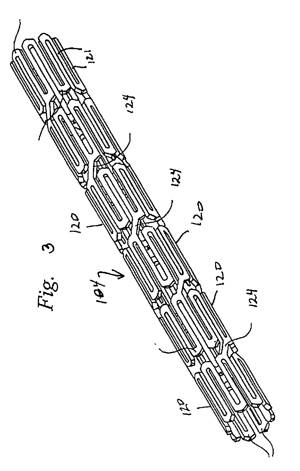 Stent for in-stent restenosis