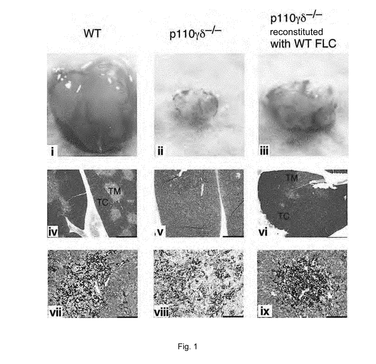 Methods and Pharmaceutical Compositions for Treating Lymphoid Malignancy