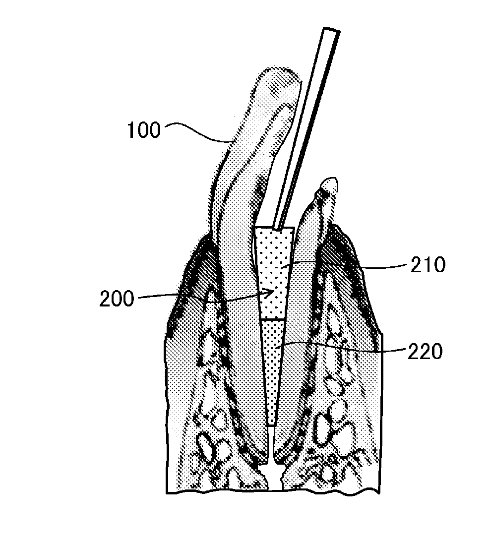 Unextracted tooth root canal filler and dental tissue regeneration method for unextracted tooth