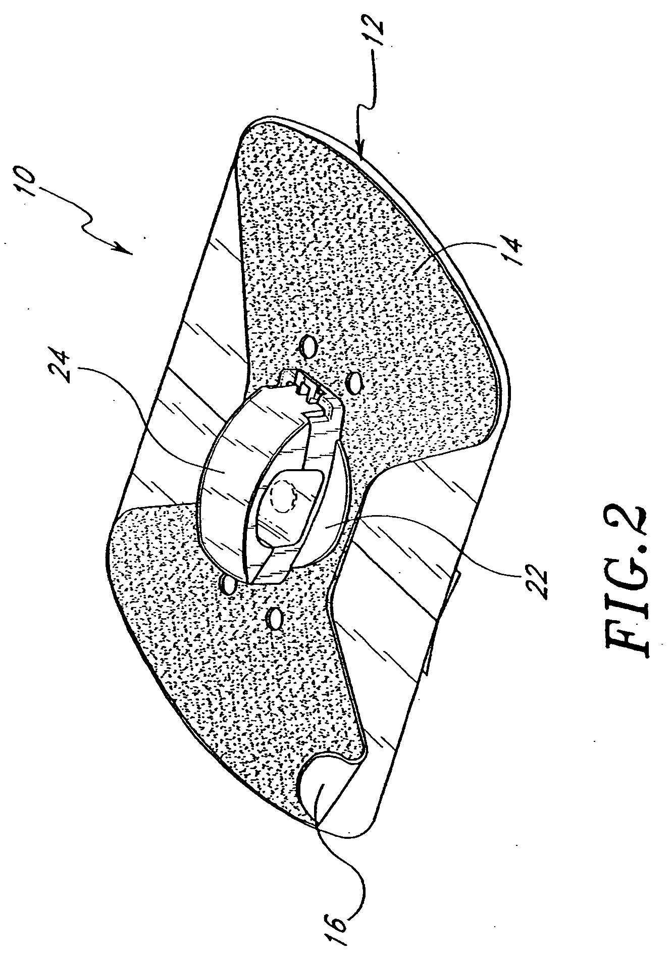 Dialysis catheter anchoring system