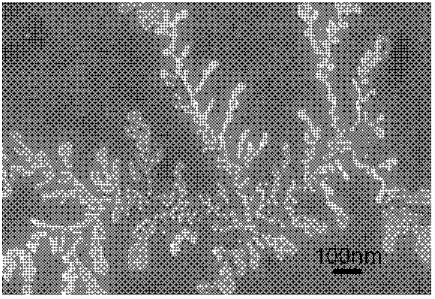 Preparation method for linear nanometre hydroxylapatite