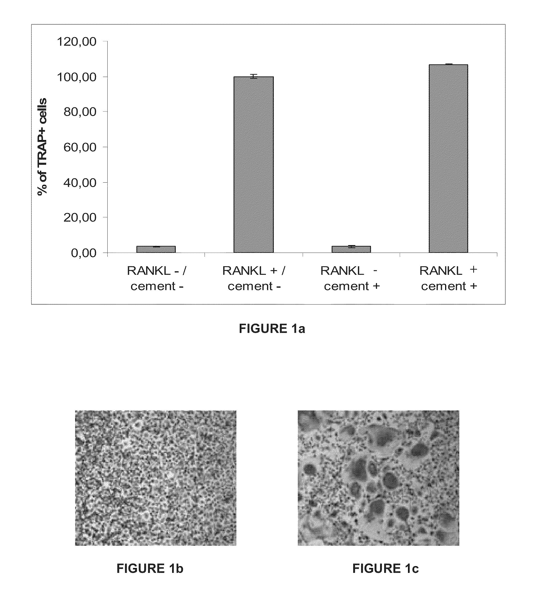 Composition for Enhancing Bone Formation