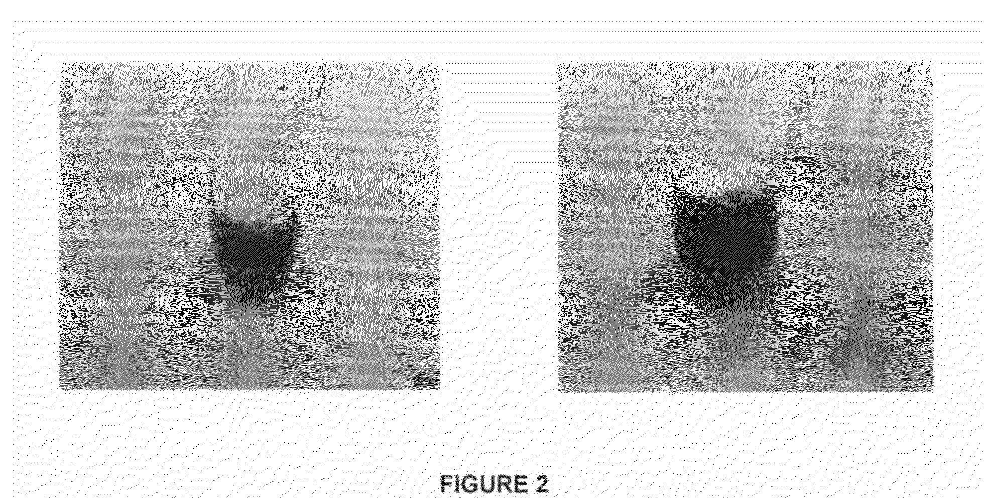 Composition for Enhancing Bone Formation