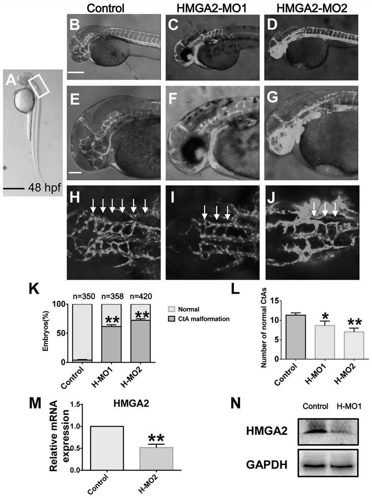 Drug targeting HMGA2 gene, and application