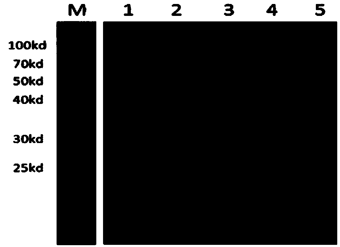 Apolygus lucorum ultraspiracle protein specific polyclonal antibody as well as preparation method and application thereof