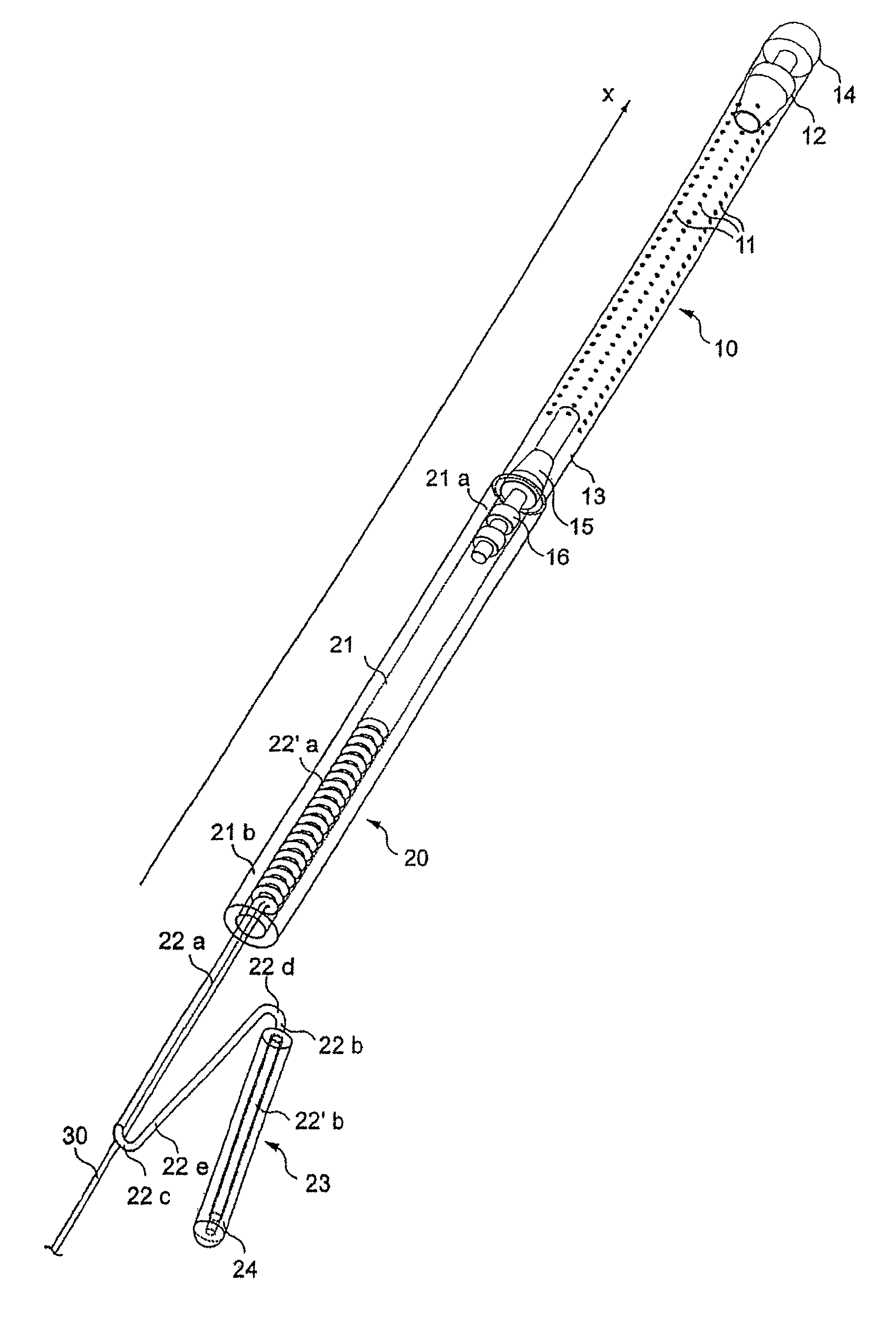 Recoverable intra-uterine system