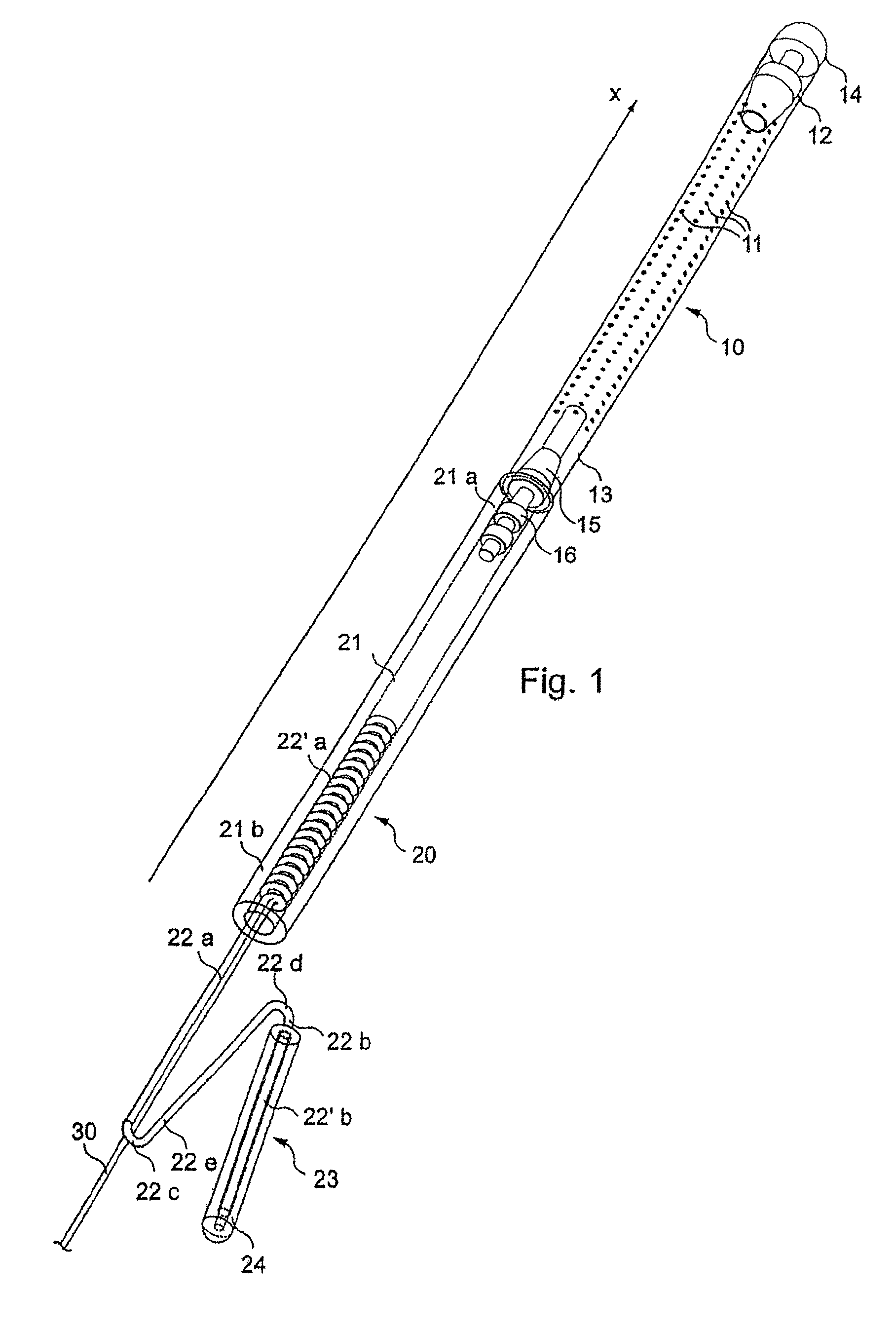 Recoverable intra-uterine system