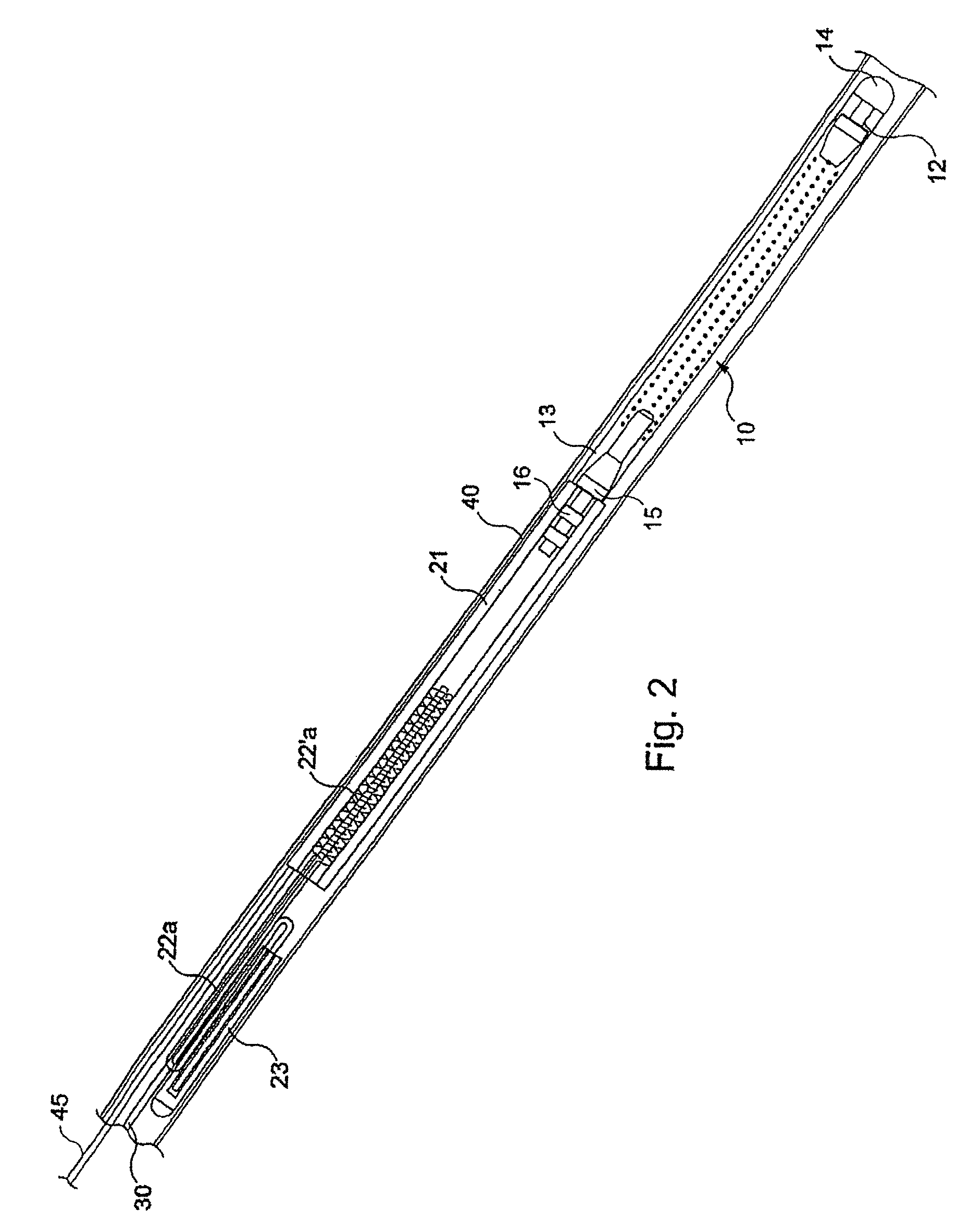 Recoverable intra-uterine system