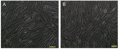 Method for culturing induced pluripotent stem cells by using human mesenchymal stem cells as trophoblast