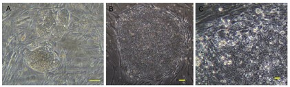 Method for culturing induced pluripotent stem cells by using human mesenchymal stem cells as trophoblast