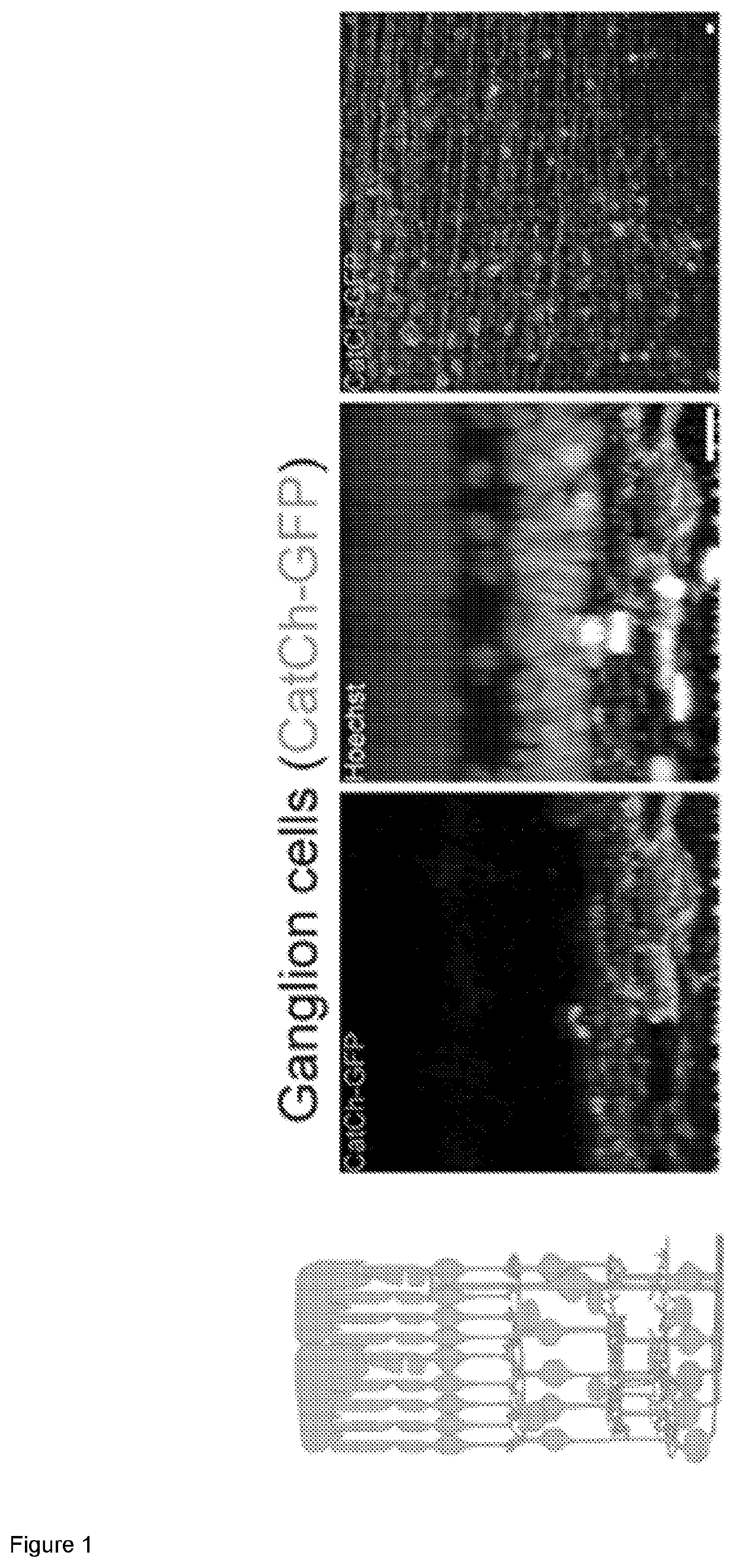 Synp66 (proa21), a promoter for the specific expression of genes in retinal ganglion cells