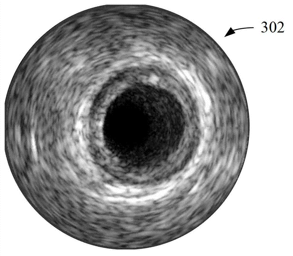 Detecting system and detecting method for ultrasonic blood vessel boundaries