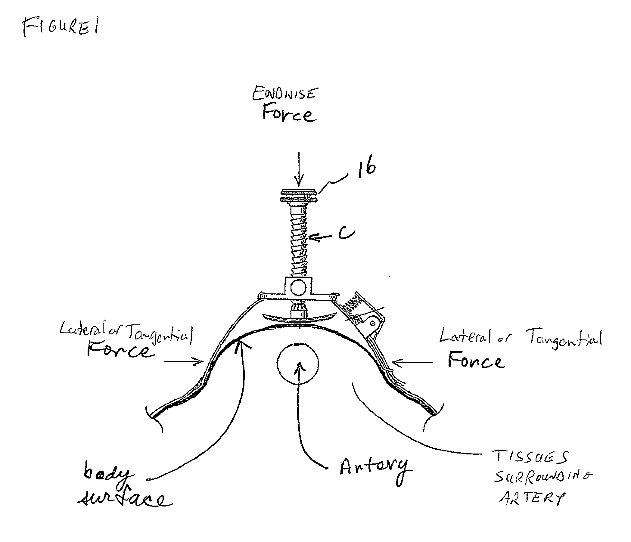 Adjustable tissue compression device