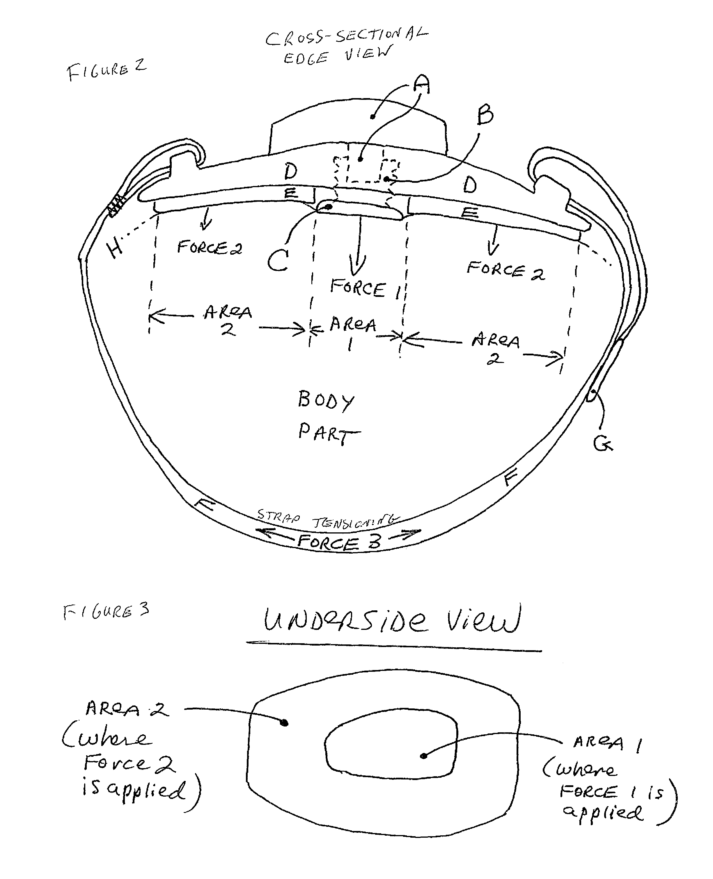 Adjustable tissue compression device