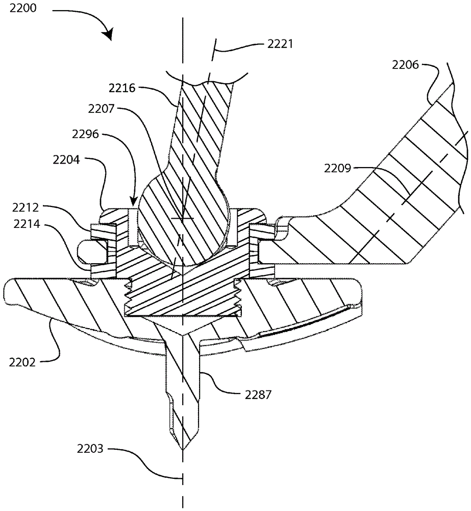 Glenoid arthroplasty and offset reamers