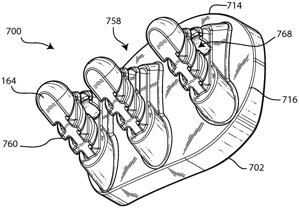 Glenoid arthroplasty and offset reamers