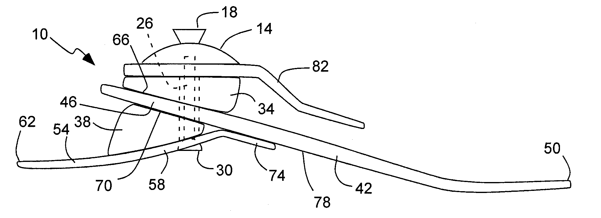 Prosthetic foot with floating forefoot keel