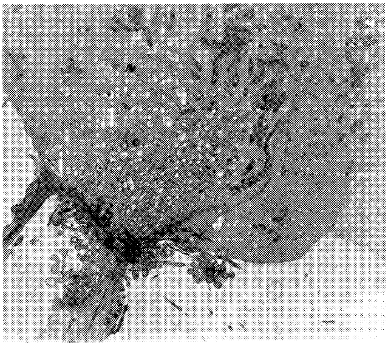 Process and culture medium for the production of cells infected by a multiple sclerosis-associated virus