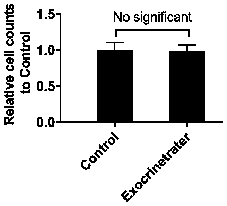 Preparation method and application of artificial exosome complex