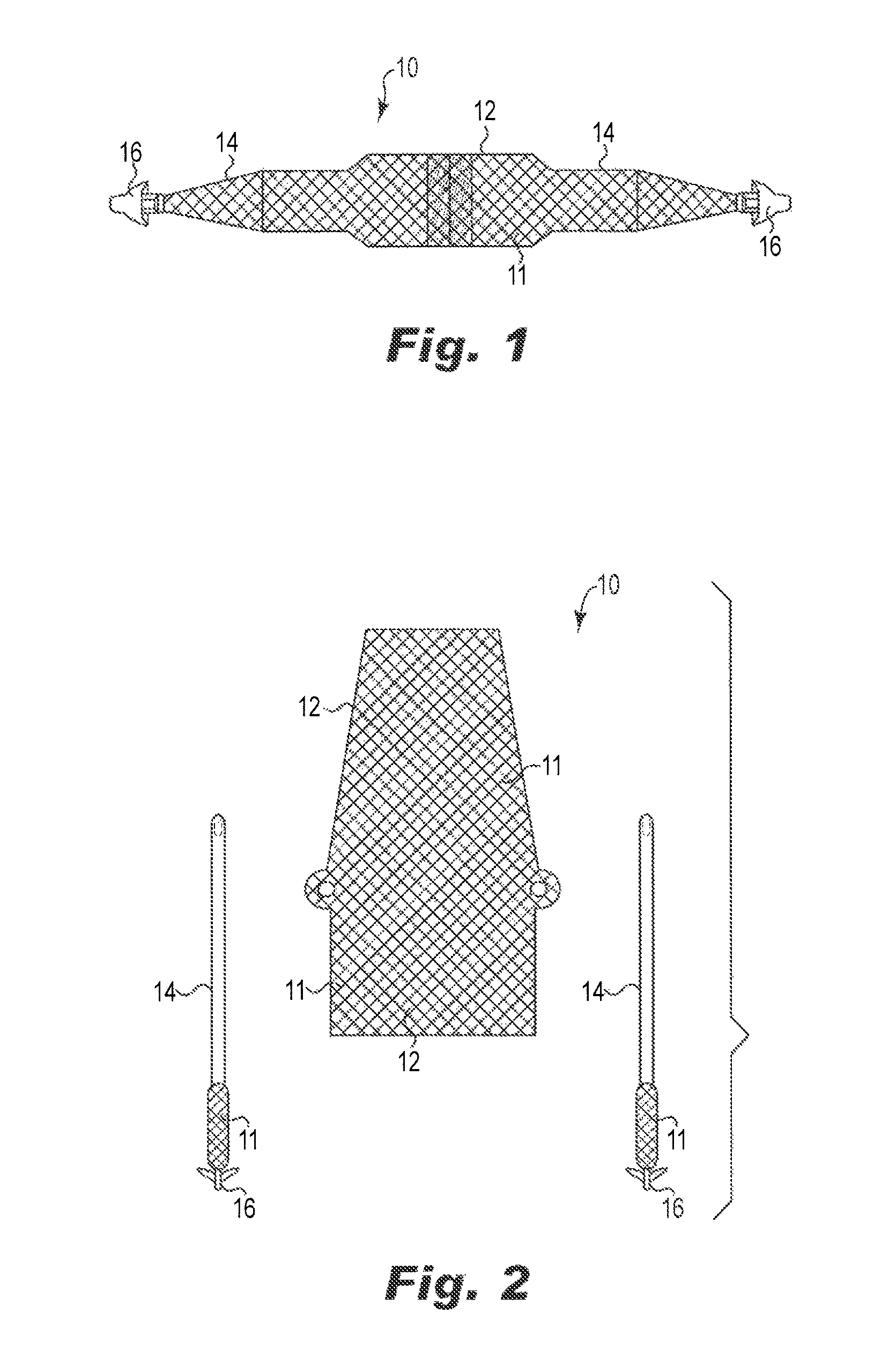 Implantable slings and anchor systems