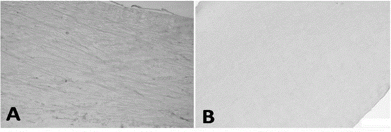 A kind of preparation method of decellularized cornea