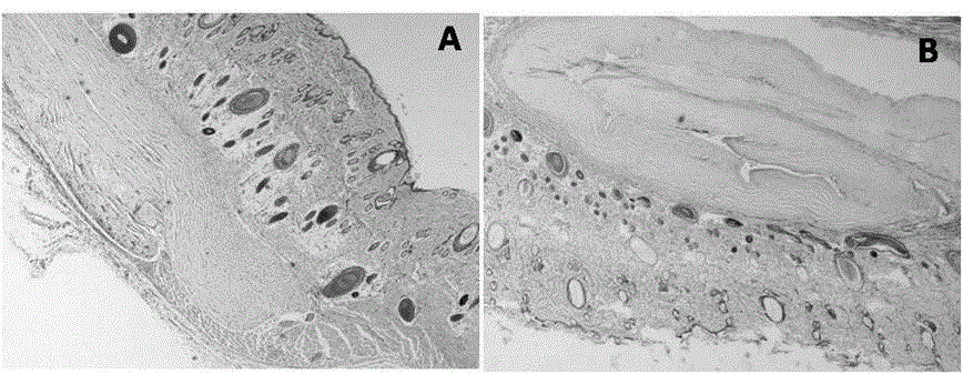 A kind of preparation method of decellularized cornea